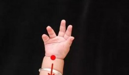 小儿风热感冒推拿视频,视频教程详解